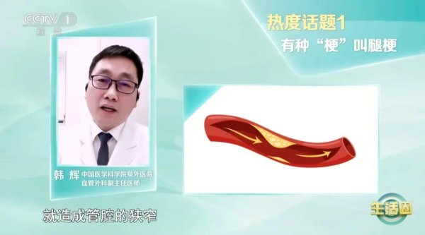 臻富配资 血管堵没堵，走两步！改掉这6个坏习惯让你的血管强大起来